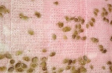 CUA XANH GIỐNG CHẤT LƯỢNG